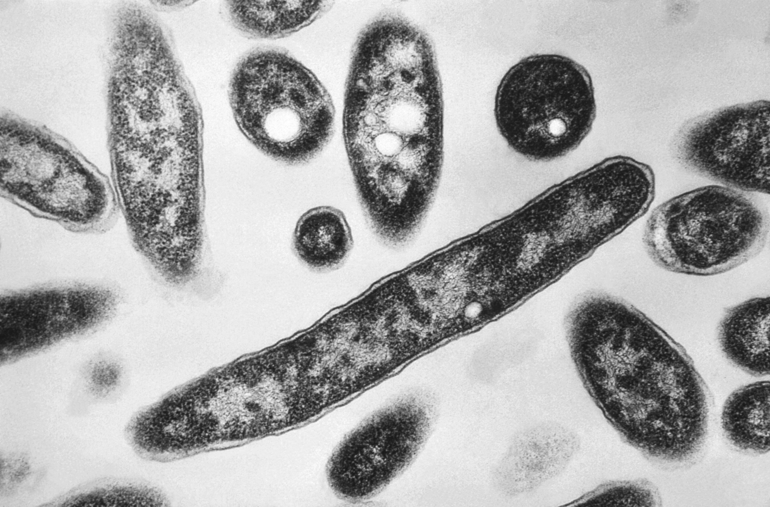 Image of Legionnaires' bacteria. (Francis Chandler/CDC via AP.)